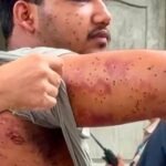 संसद मार्च के दौरान आरएएफ जवान ने दागे थे पेलेट राउंड