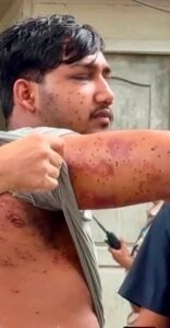 संसद मार्च के दौरान आरएएफ जवान ने दागे थे पेलेट राउंड