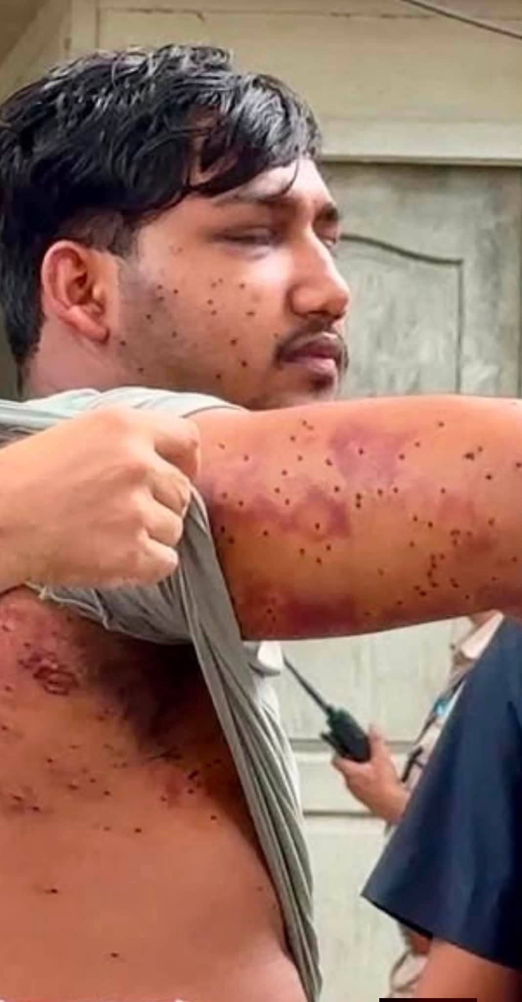 संसद मार्च के दौरान आरएएफ जवान ने दागे थे पेलेट राउंड