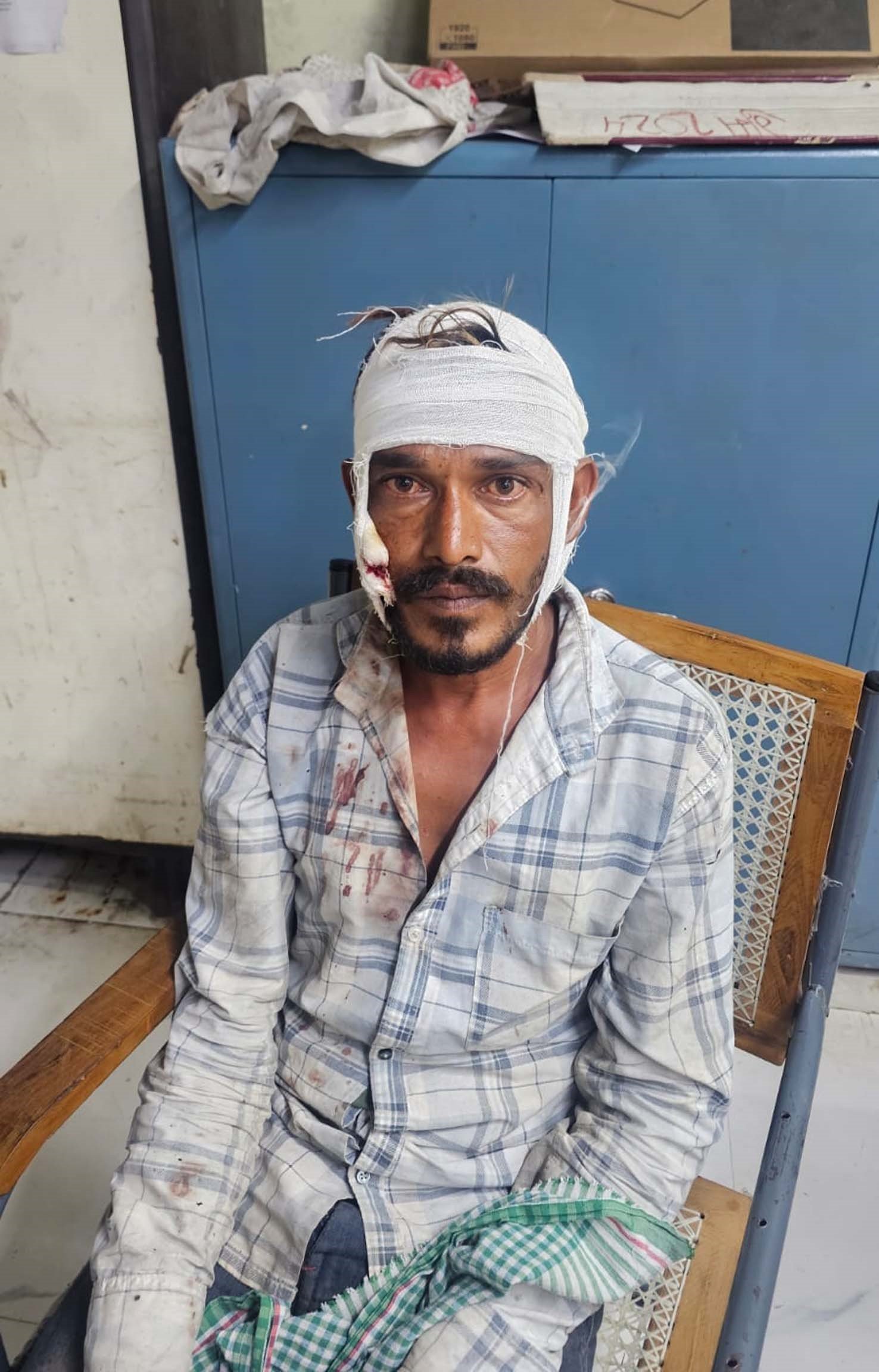 टीवी चैनल बदलने से भड़की पत्नि ने पति पर किया हंसिये से वार